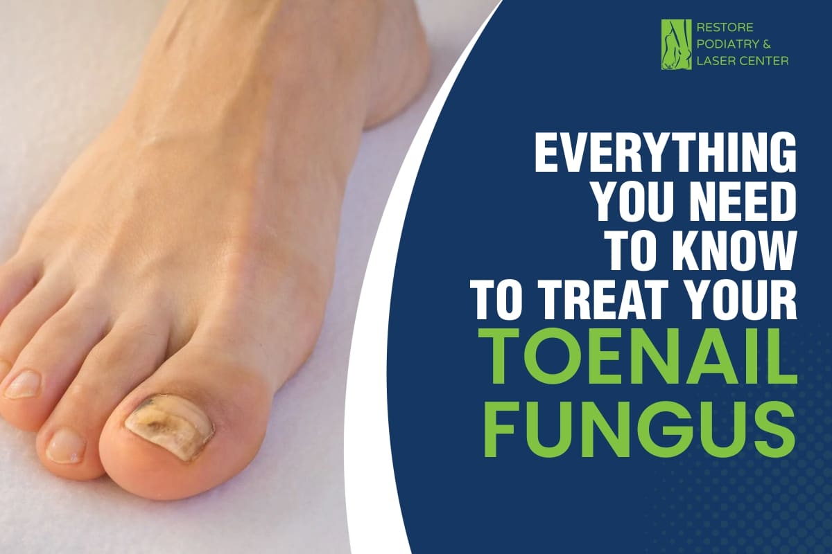 Everything You Need to Know to Treat Your Toenail Fungus