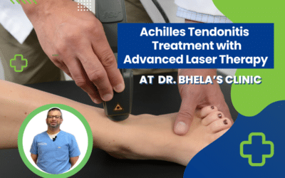 Alleviating Achilles Tendonitis with Advanced Laser Therapy