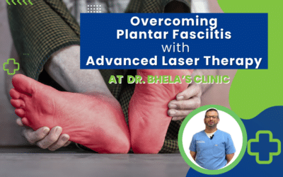 Overcoming Plantar Fasciitis with Dr. Bhela’s Advanced Laser Therapy