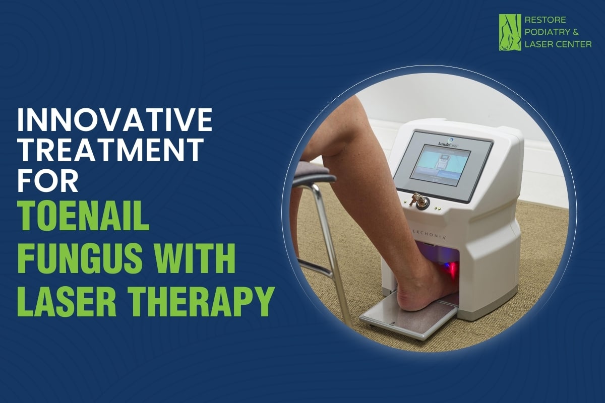 Innovative Treatment for Toenail Fungus with Laser Therapy