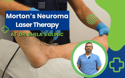 Morton’s Neuroma: Find Relief with Dr. Bhela’s Laser Therapy