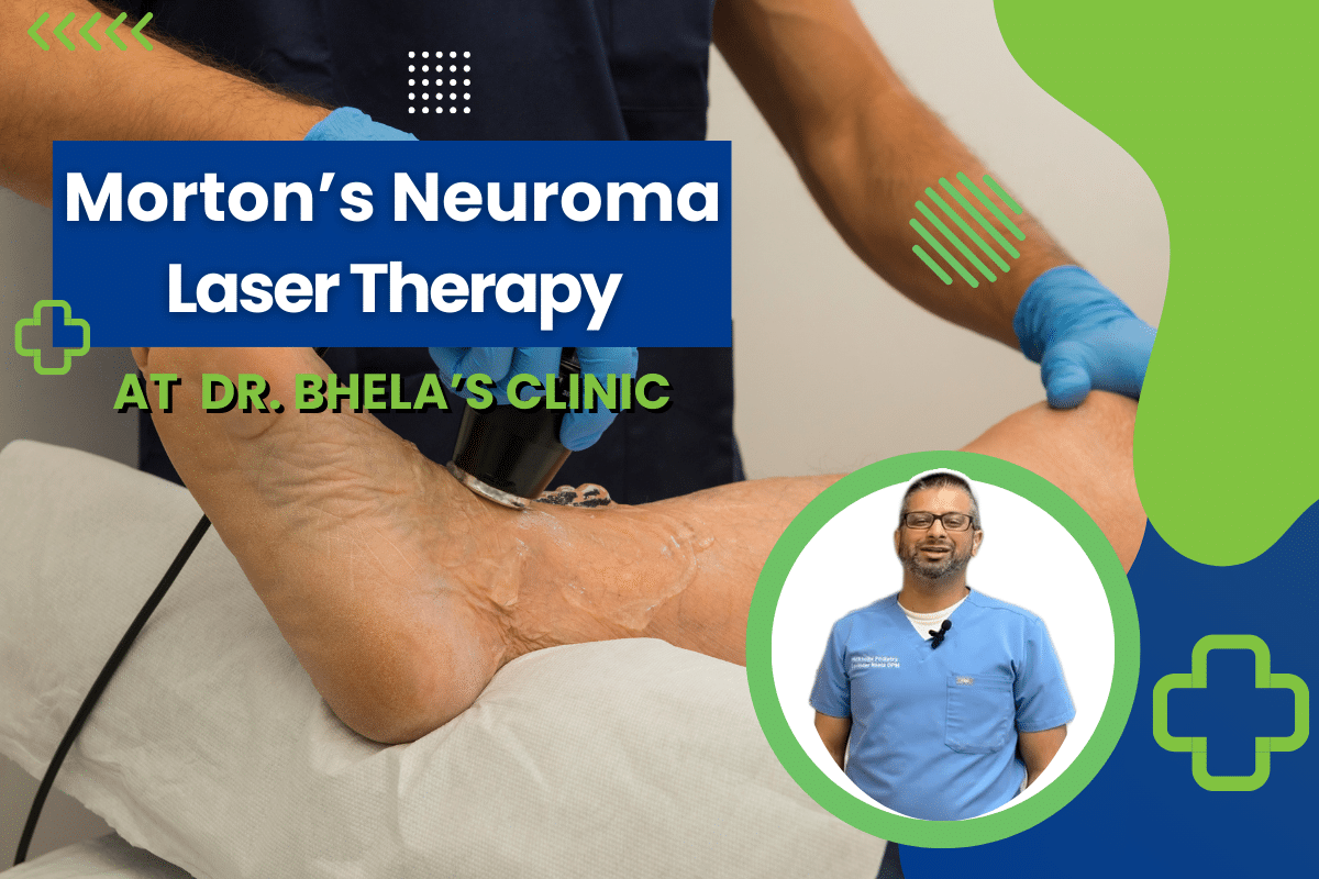 Select Morton’s Neuroma: Find Relief with Dr. Bhela’s Laser Therapy Morton’s Neuroma: Find Relief with Dr. Bhela’s Laser Therapy