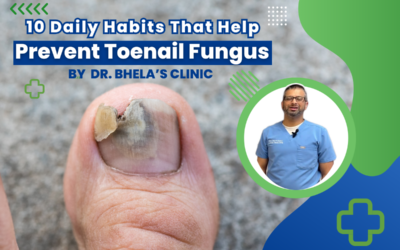 10 Daily Habits That Help Prevent Toenail Fungus