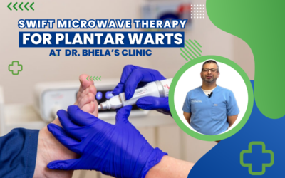 How Effective is Swift Therapy for Plantar Warts