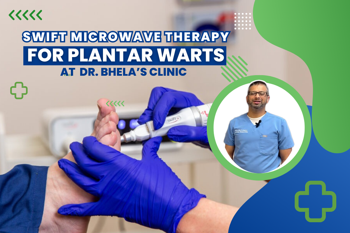 How Effective is Swift Therapy for Plantar Warts