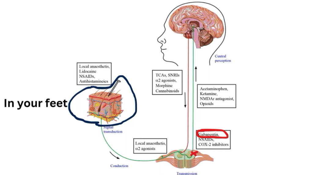 A cartoon diagram illustrating pain signal transmission to the brain