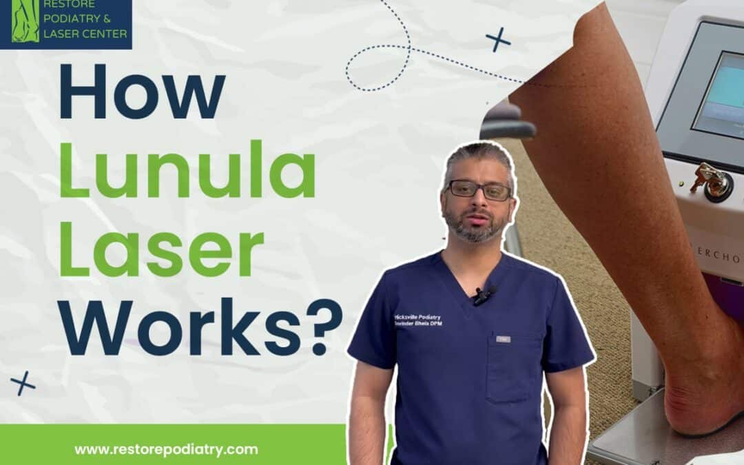 Lunula Laser Therapy – Painless, Non-Invasive Toenail Fungus Treatment 