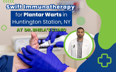 Swift Immunotherapy for Plantar Warts in Huntington Station, NY  