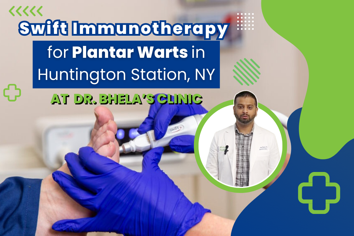 Swift Immunotherapy for Plantar Warts in Huntington Station, NY  