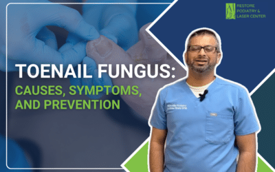 Toenail Fungus: Causes, Symptoms, and Prevention