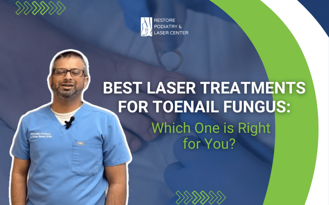 Best Laser Treatments for Toenail Fungus: Which One is Right for You?