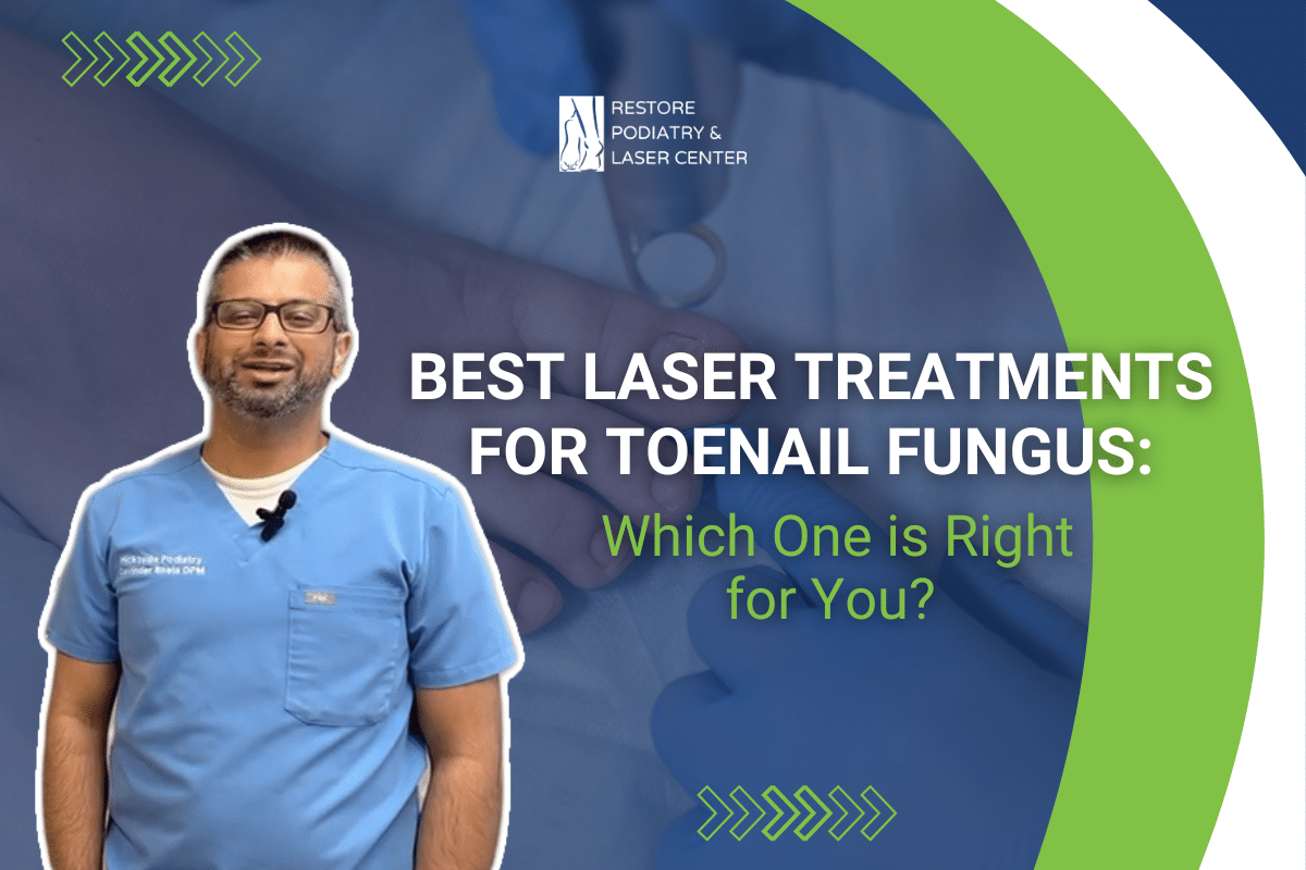 Best Laser Treatments for Toenail Fungus: Which One is Right for You?