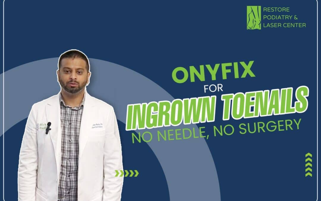 Non-surgical Onyfix Treatment for Ingrown Toenails