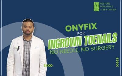 Non-surgical Onyfix Treatment for Ingrown Toenails