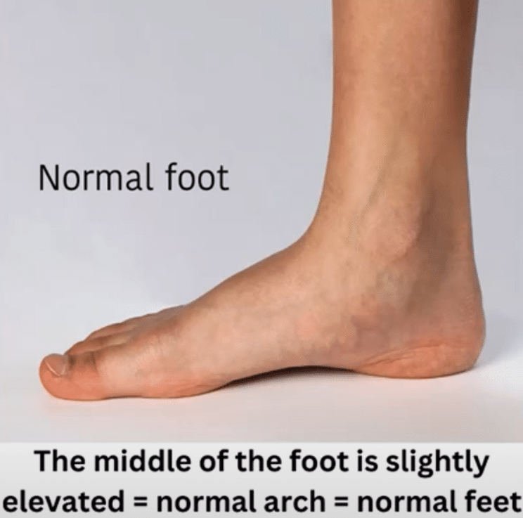 Normal Foot Structure