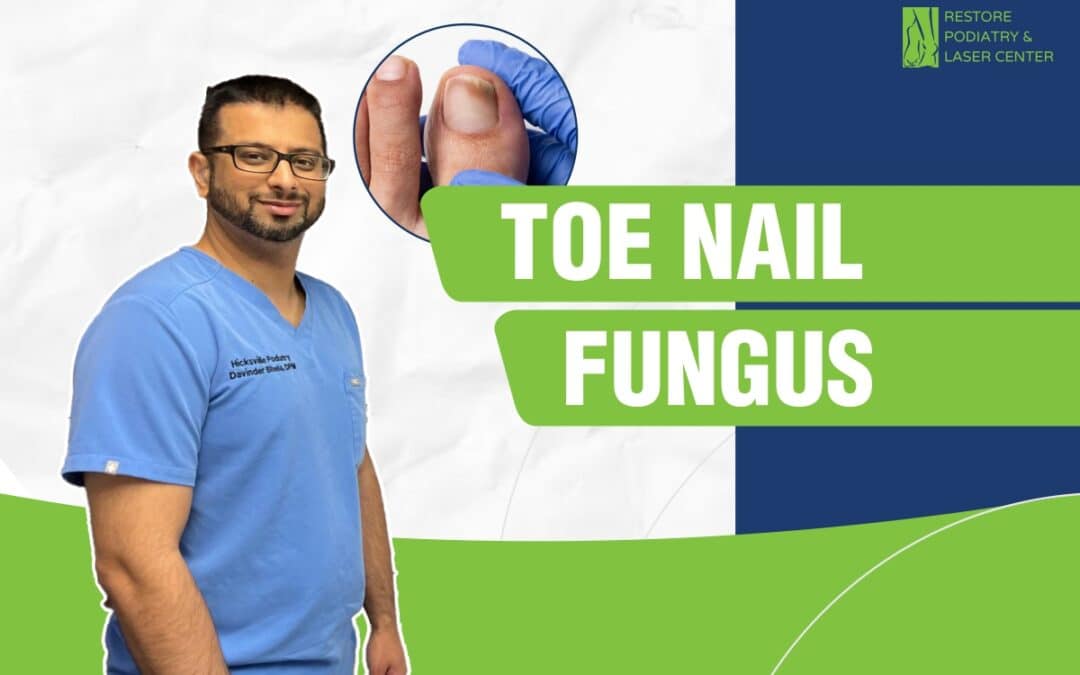 Toenail Fungus: Causes and Laser Treatment For Prevention