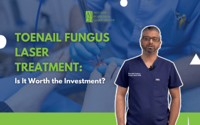 Toenail Fungus Laser Treatment: Is It Worth the Investment?