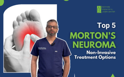 Top 5 Morton’s Neuroma Non-Invasive Treatment Options