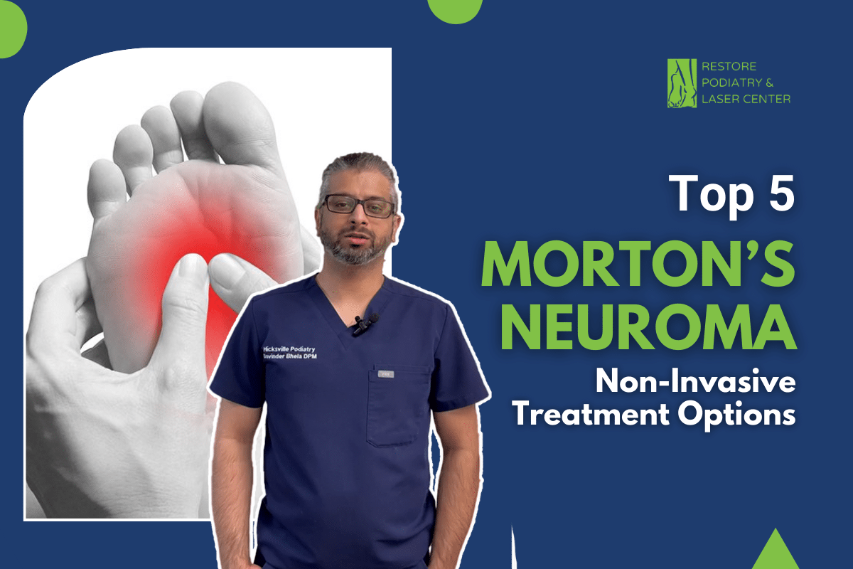 Top 5 Morton’s Neuroma Non-Invasive Treatment Options