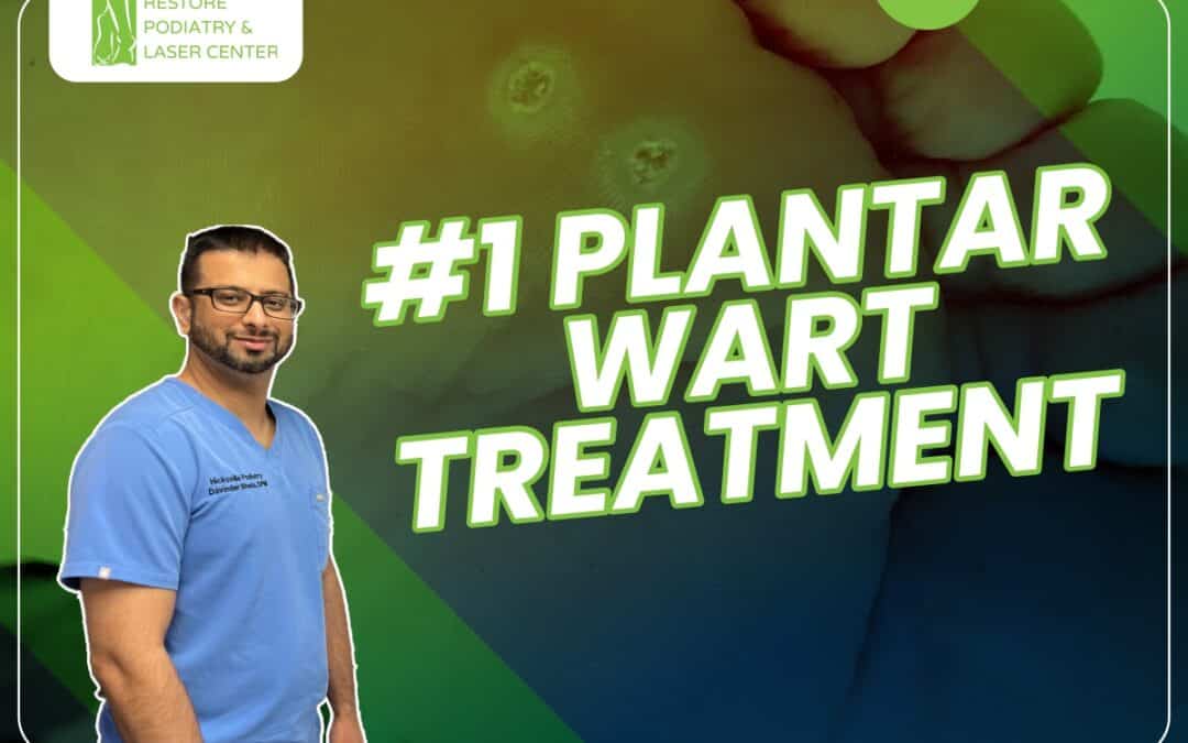 #1 Plantar Warts Treatment