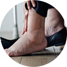 Diabetic Foot care - Restore Podiatry