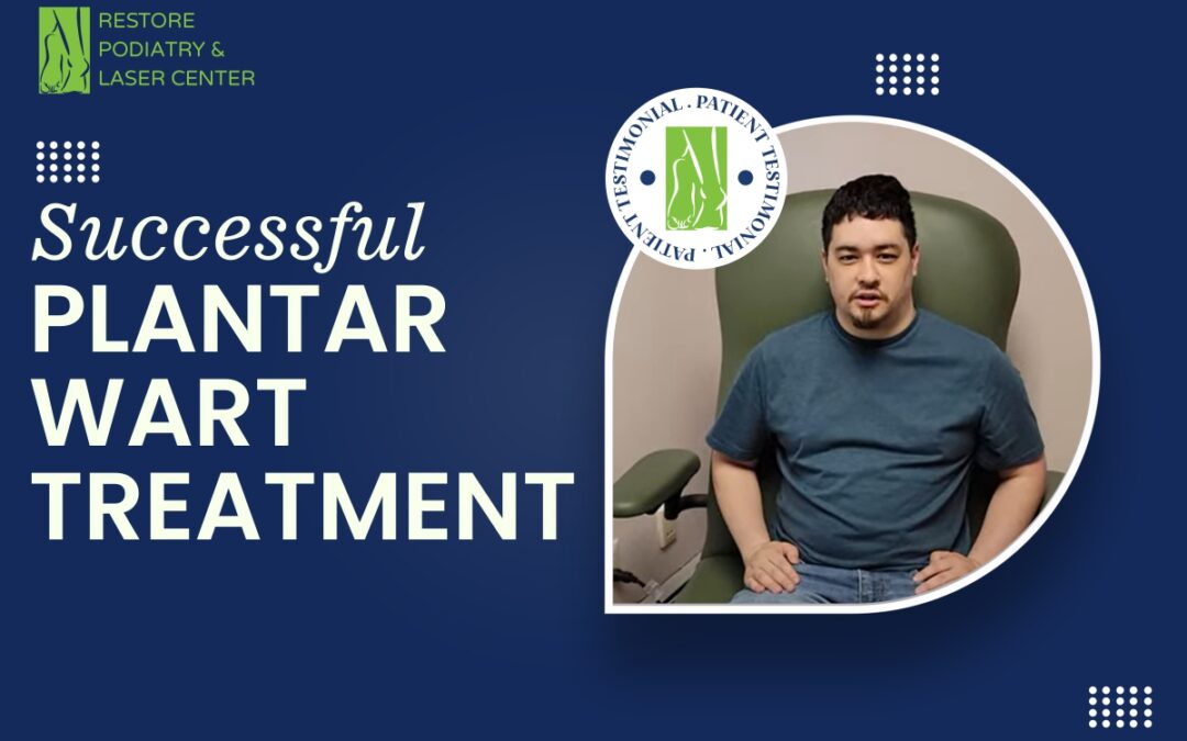 Patient Testimonial on Successful Plantar Wart Treatment