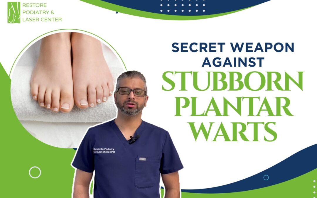 Secret Weapon Against Stubborn Plantar Warts