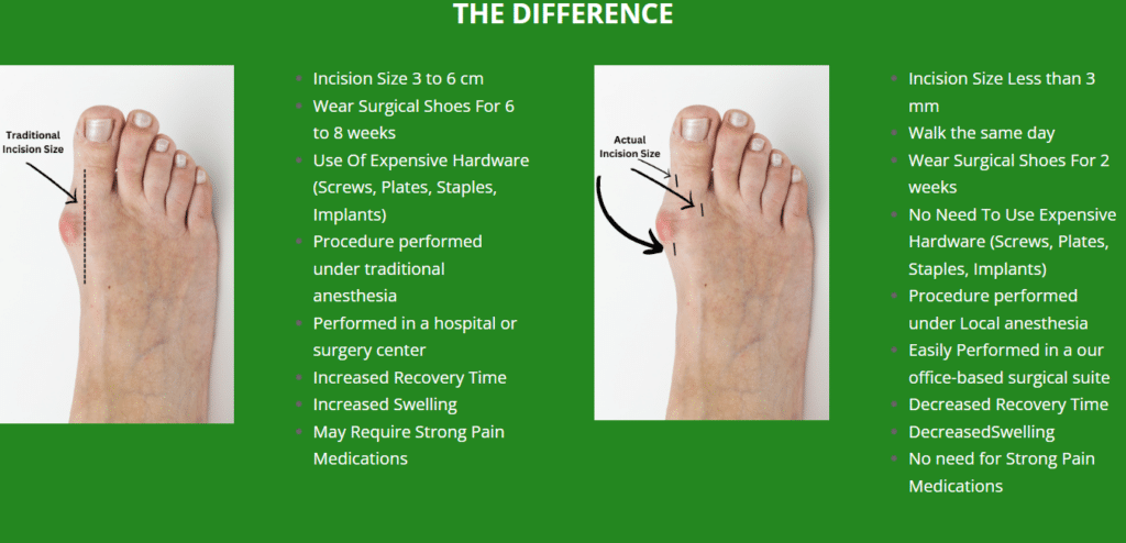 The Difference Between Traditional and Minimally Invasive Foot Surgery