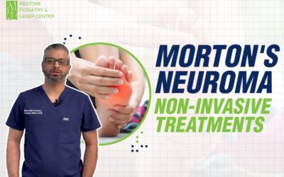 #1 Non-Invasive Treatment Of Morton’s Neuroma