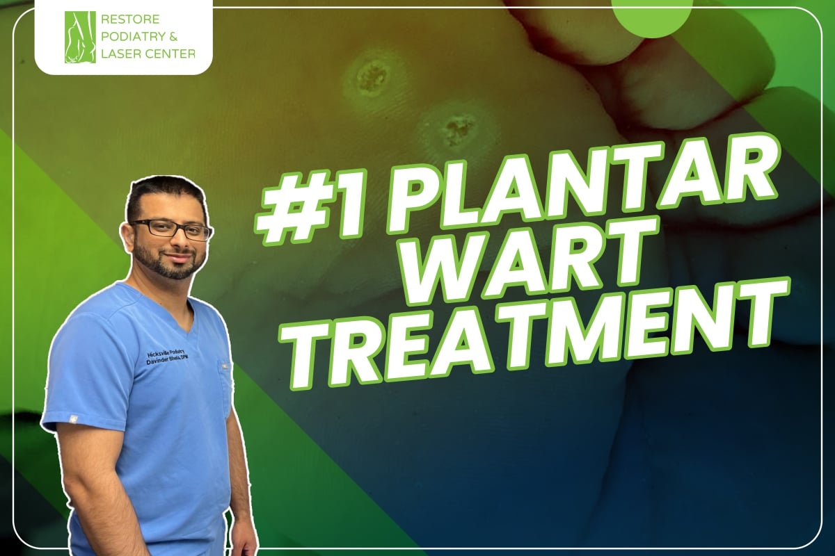 1-Plantar-Warts-Treatment