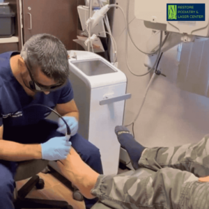 Advanced laser therapy for toenail fungus - Restore Podiatry