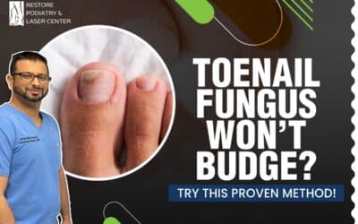 Best Treatment for Toenail Fungus Over 5 Years 