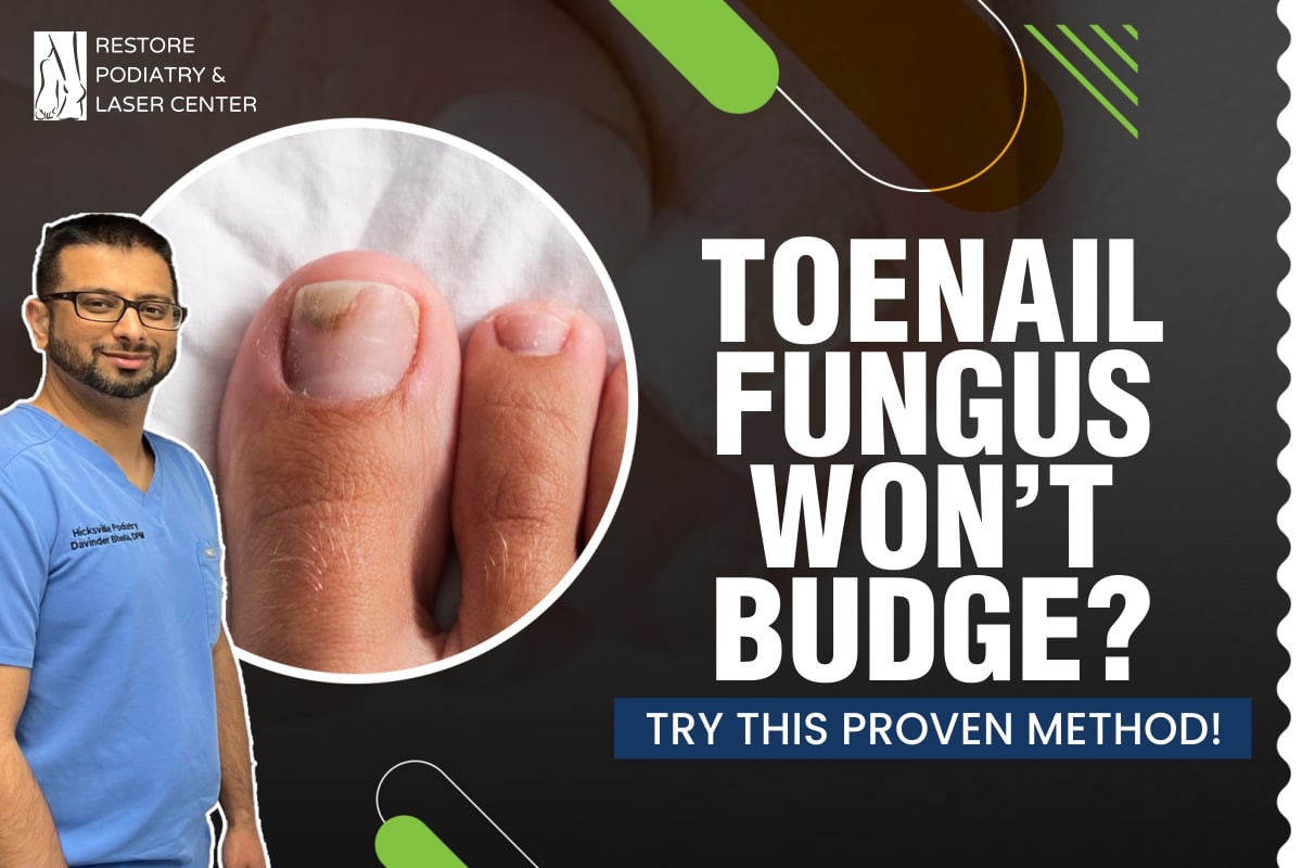 Best-Treatment-for-Toenail-Fungus-Over-5-Years-