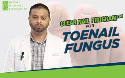 Exclusive Clear Nail Program™ For Toenail Fungus