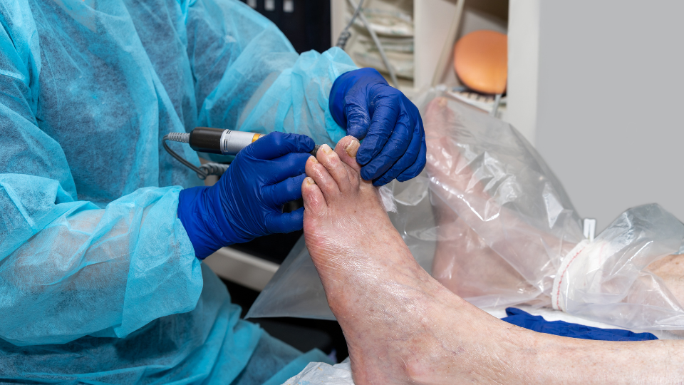 High intensity laser therapy - Restore Podiatry