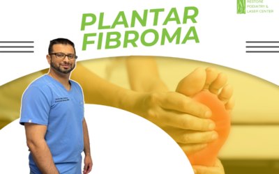 High-Power Laser Therapy For Plantar Fibromas | No Injection, No Surgery