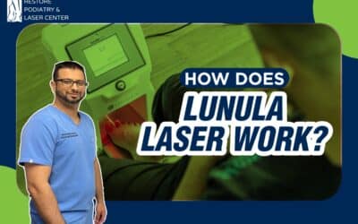 Lunula Laser For Stubborn Toenail Fungus