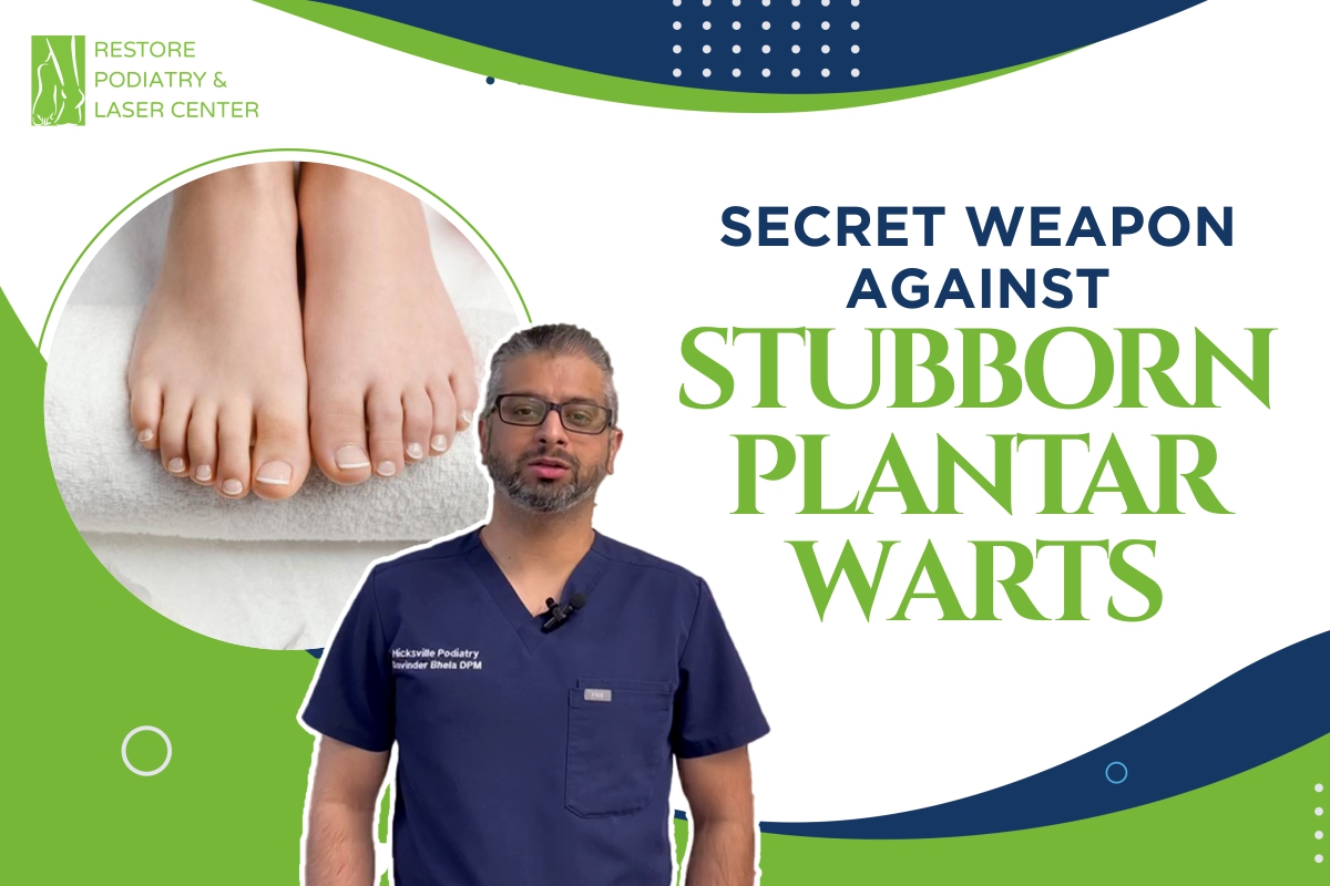 Secret-Weapon-Against-Stubborn-Plantar-Warts