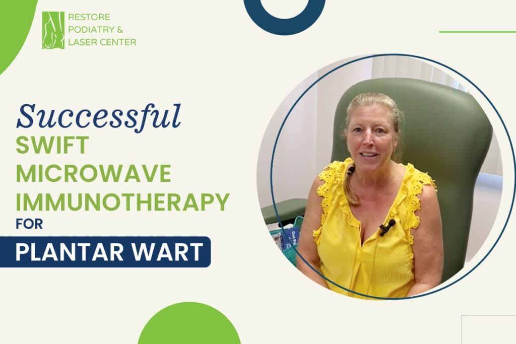Successfully-Treated-Plantar-Warts-With-Swift-Microwave-Therapy