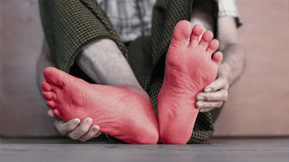 Idiopathic Neuropathy treatment options