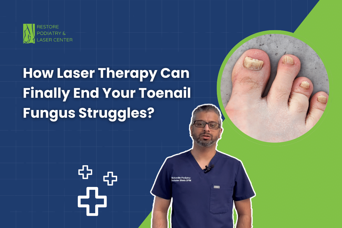 How Laser Therapy Can Finally End Your Toenail Fungus Struggles