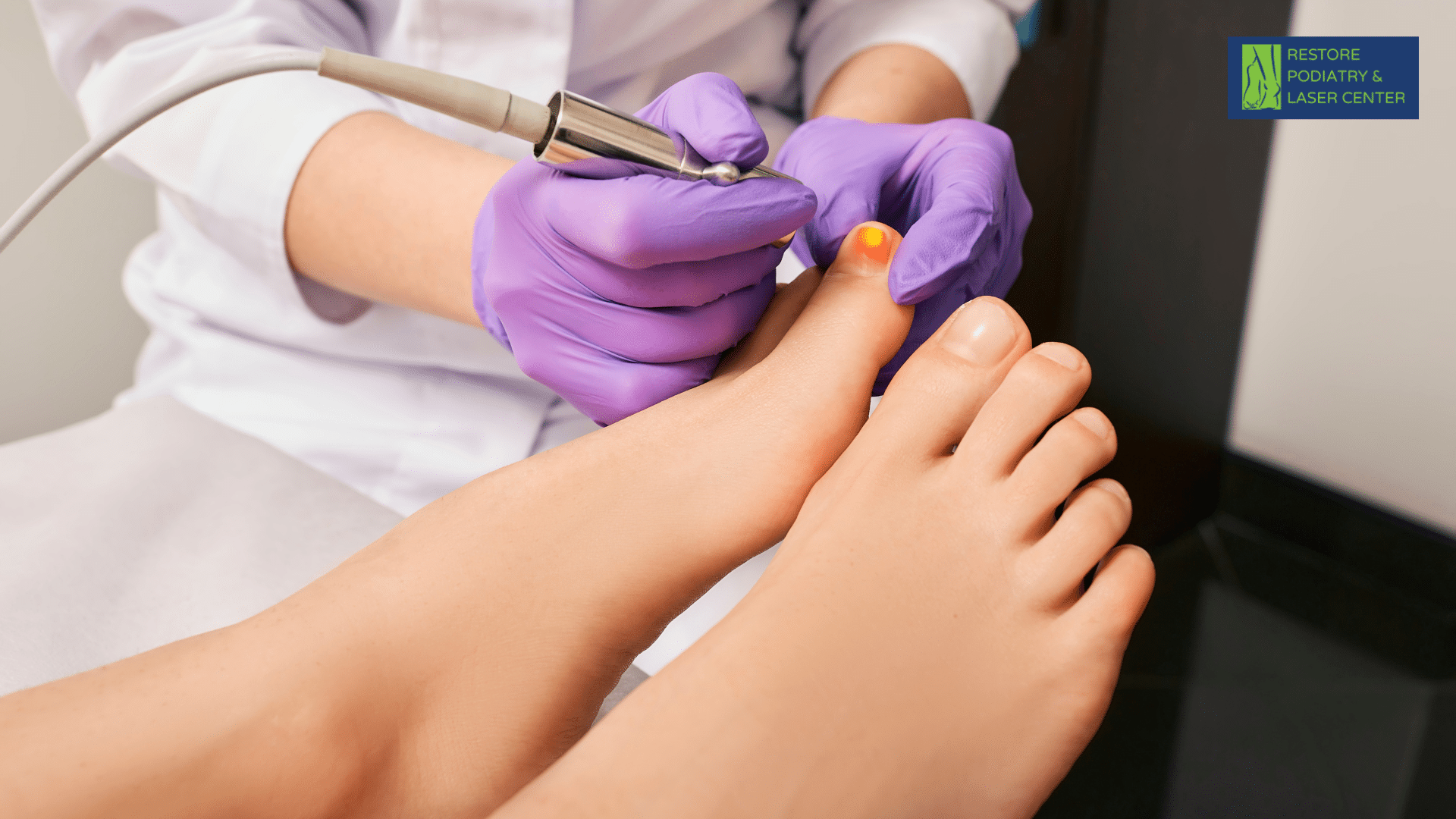 Laser Treatment for Toenail Fungus