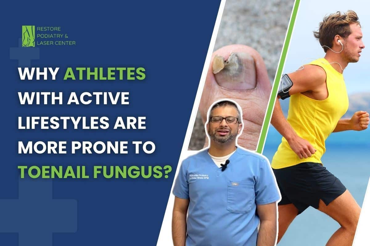 Why Athletes with Active Lifestyles Are More Prone to Toenail Fungus