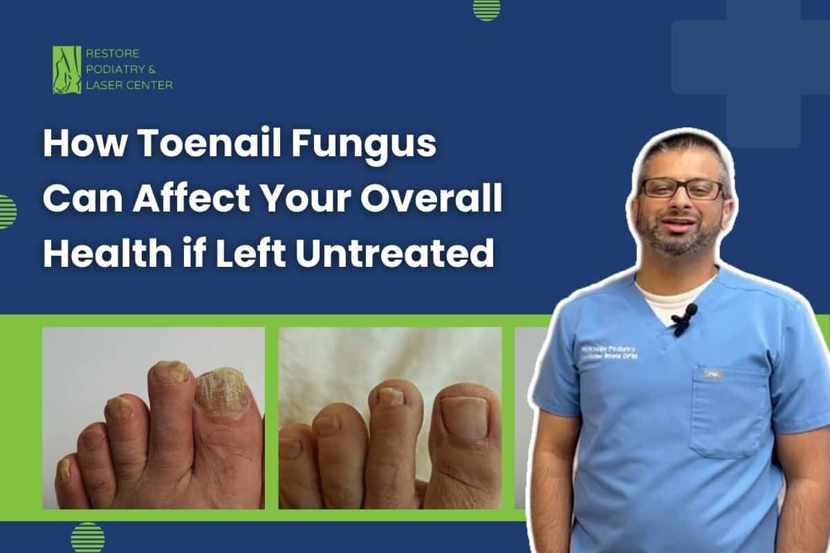 How Toenail Fungus Can Affect Your Overall Health if Left Untreated