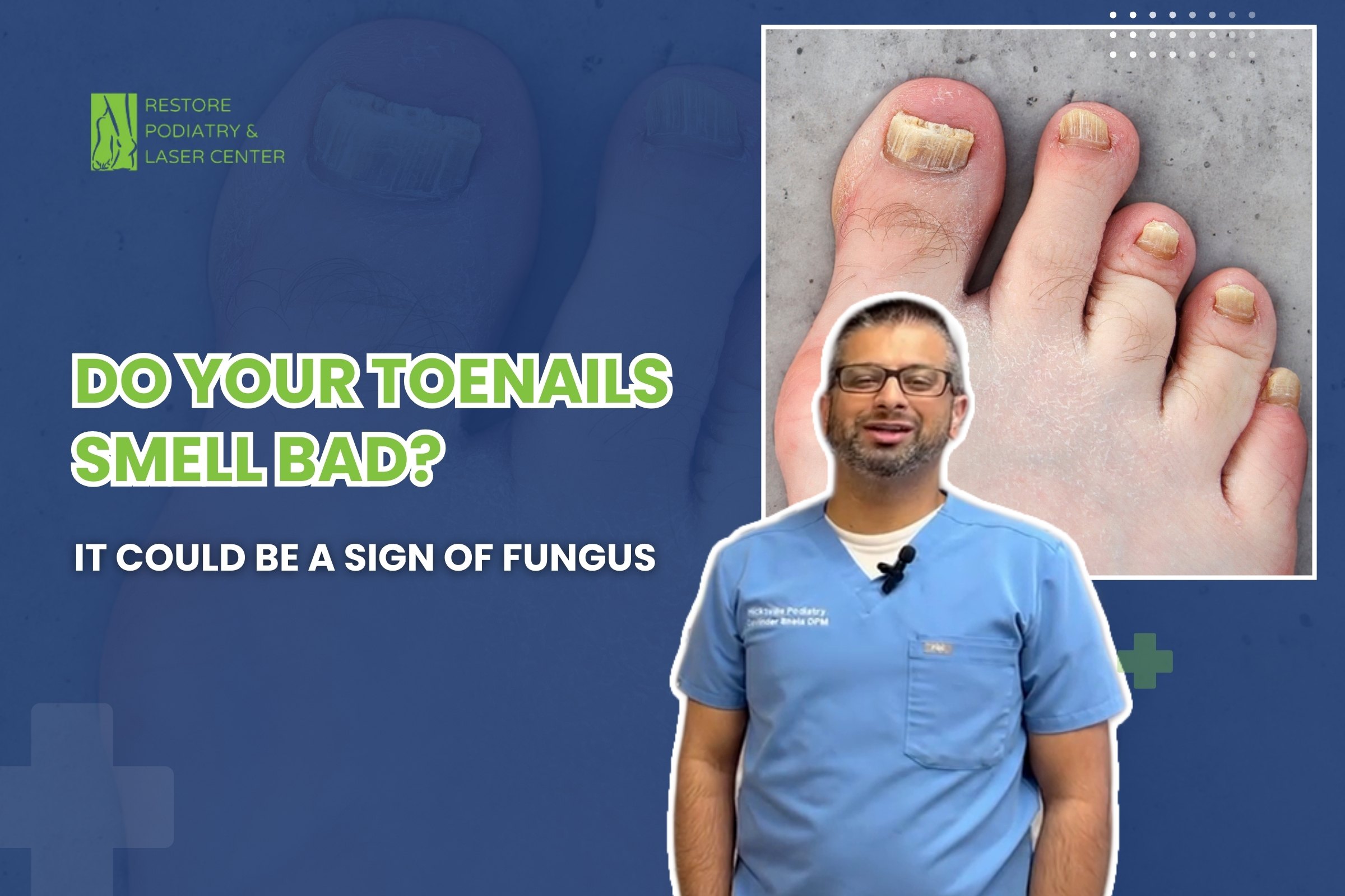 Do Your Toenails Smell Bad It Could Be a Sign of Fungus