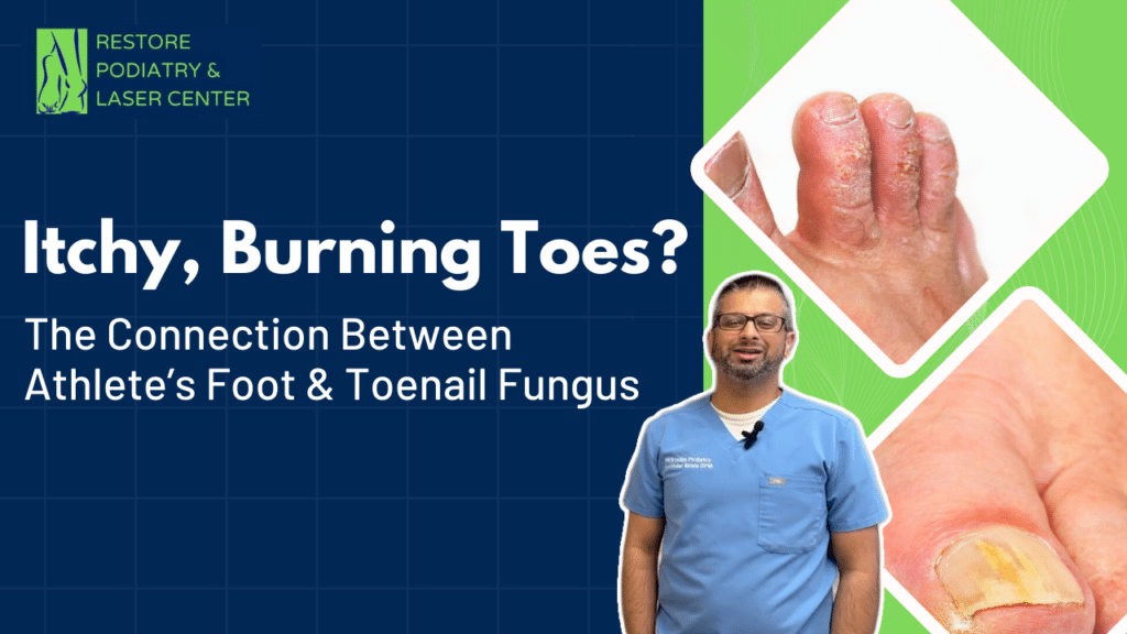 Itchy, Burning Toes The Connection Between Athlete’s Foot and Toenail Fungus