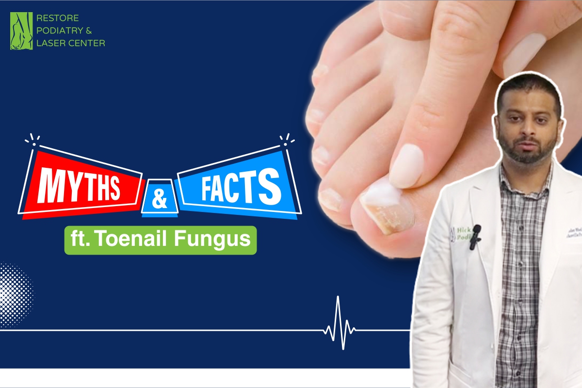 Myths VS Facts Ft. Toenail Fungus