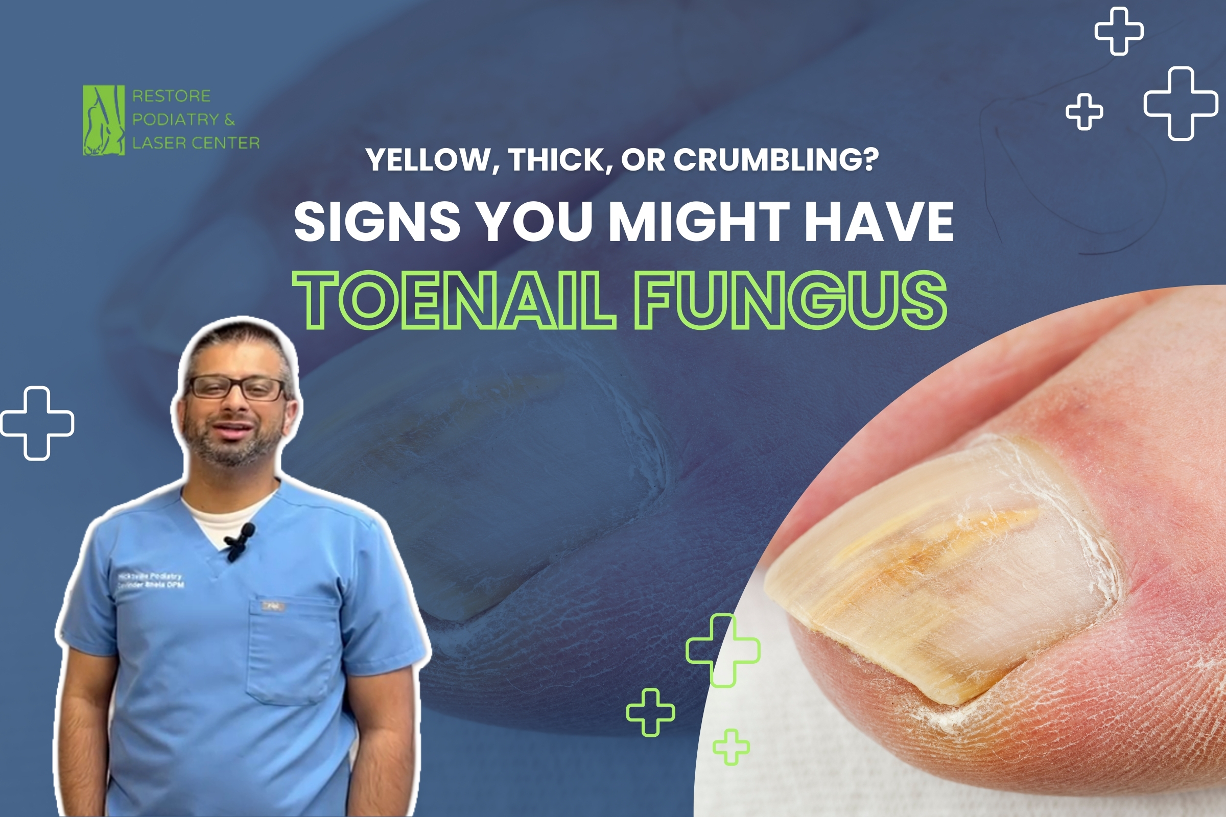 Yellow, Thick, or Crumbling Signs You Might Have Toenail Fungus