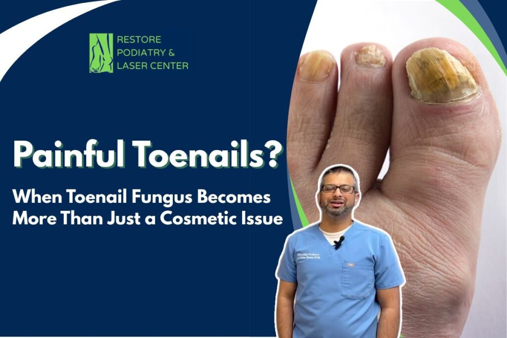 Painful Toenails When Toenail Fungus Becomes More Than Just a Cosmetic Issue