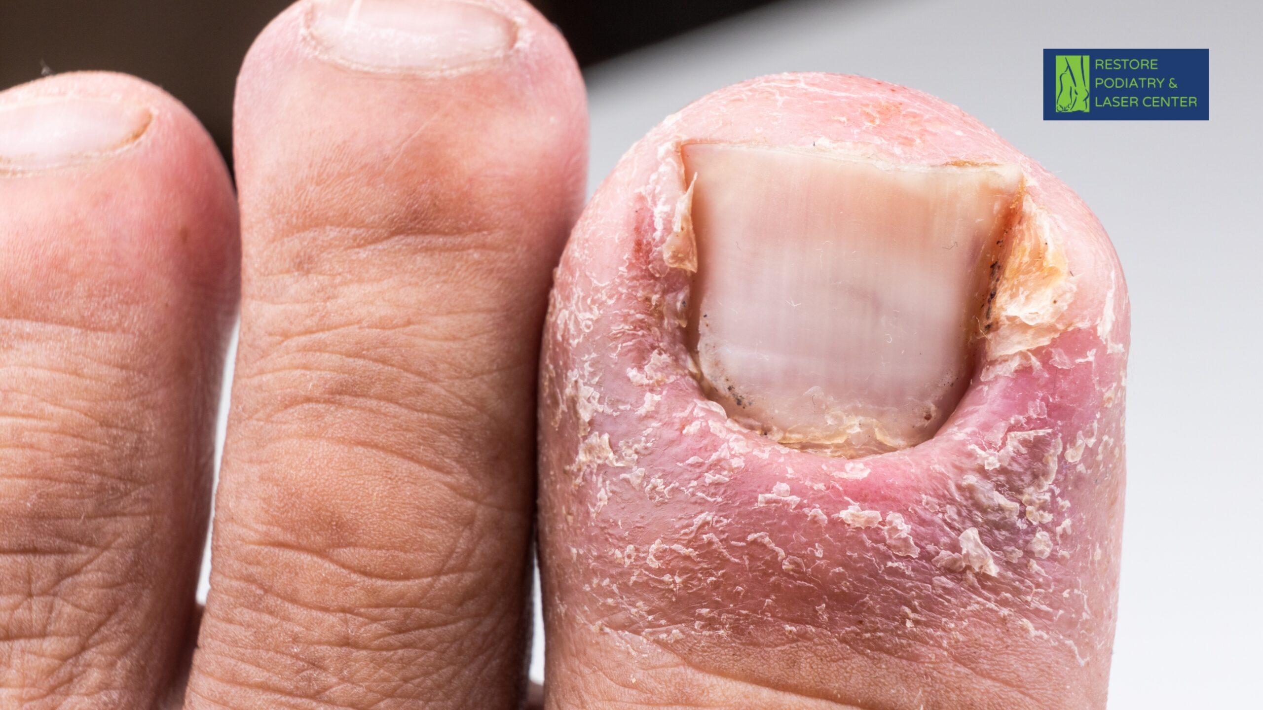 Redness, pain, swelling, or pus can be signs of infection